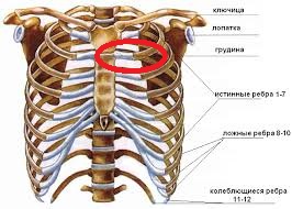 Друг съехал с горки