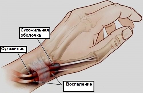 Кто последний, тот победил?