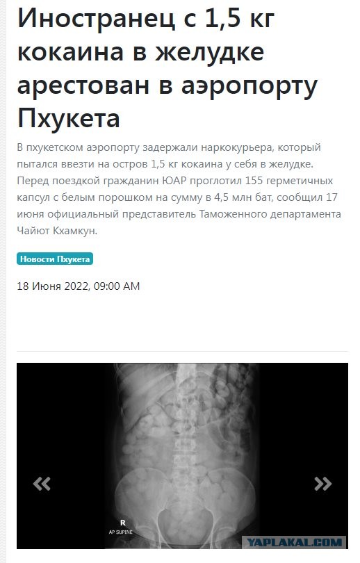 Во Внуково задержали девушку с полкило кокаина в желудке