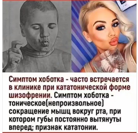 Девушка записала видео с посылом «как в почти 39 выглядеть на 20», демонстрируя себя в зеркале после всех возможных уколов