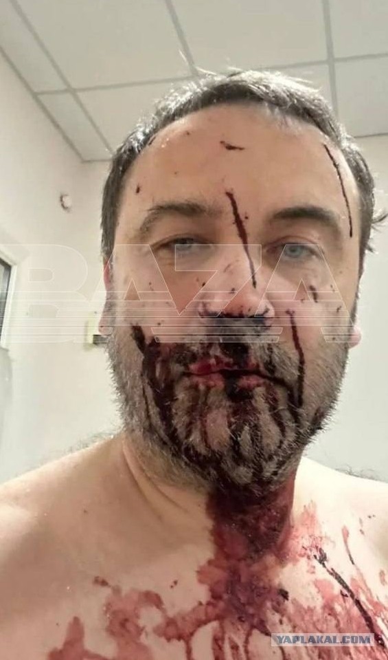 В дом экс-депутата Думы Ильи Пономарева в Киевской области влетел дрон