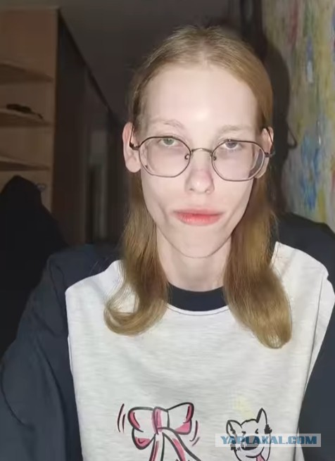 Где будет следующий укус?