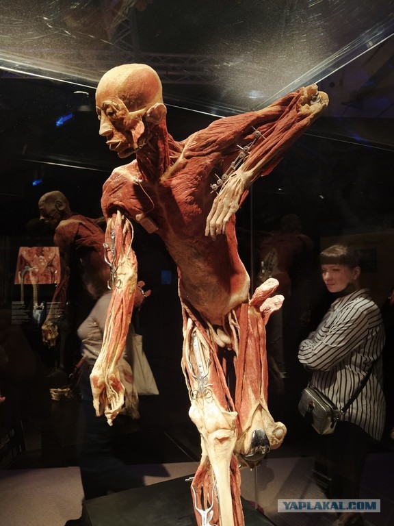 Посетил выставку Body Worlds на ВДНХ