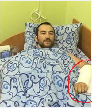 Задержанному Ерофееву сломали руку