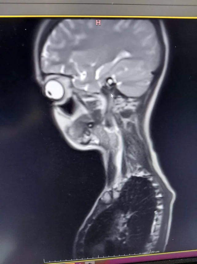 7 странных вопросов о нашем теле