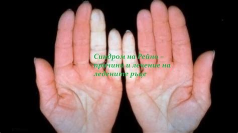 Есть тут доктора? Что с пальцем?