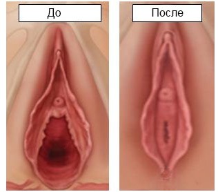 Один день с профессором, акушером-гинекологом, хирургом...