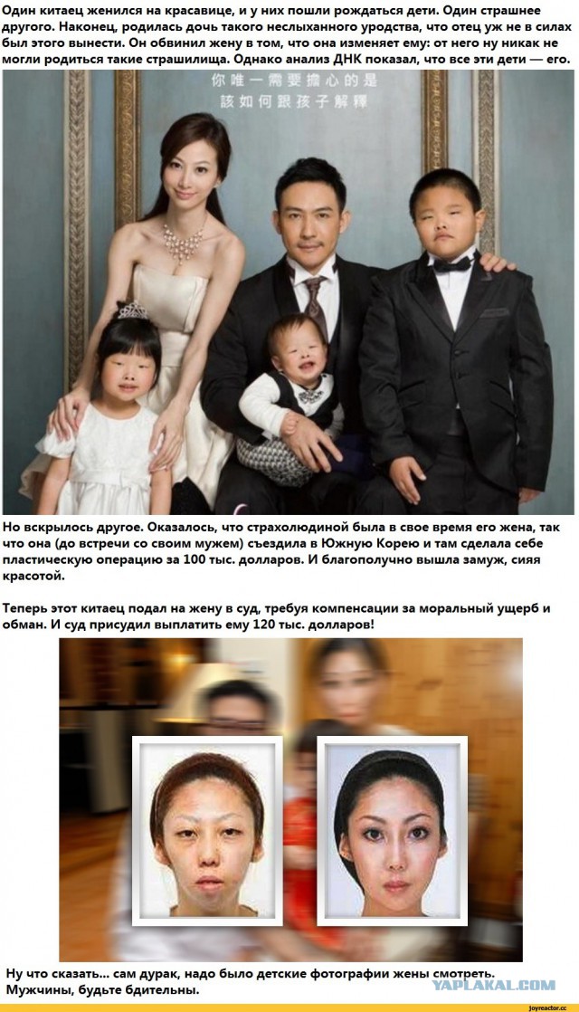 Китаянка изменила разрез глаз, потратив $35 тыс., чтобы выглядеть "по-европейски"