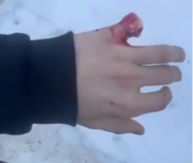 В Воскресенске лютый дед продырявил руку и отстрелил палец курьеру Озона