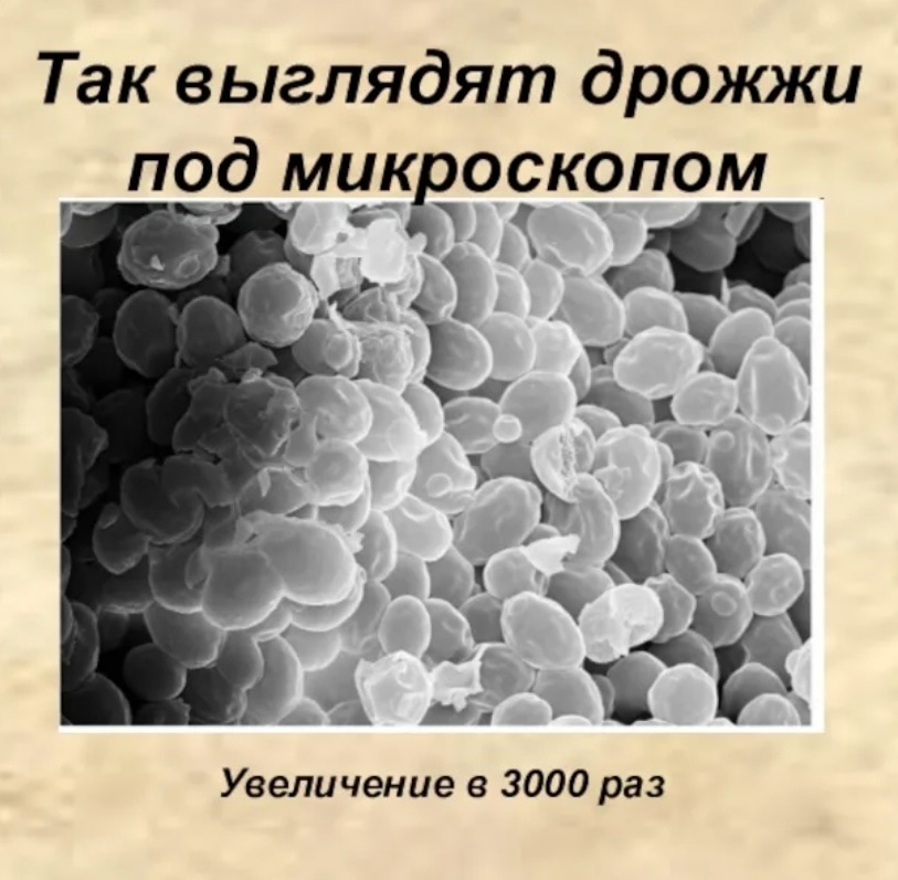 Дрожжи под микроскопом строение Смотреть как булочки выпекаются в духовке не менее приятно, чем их есть - ЯПлака