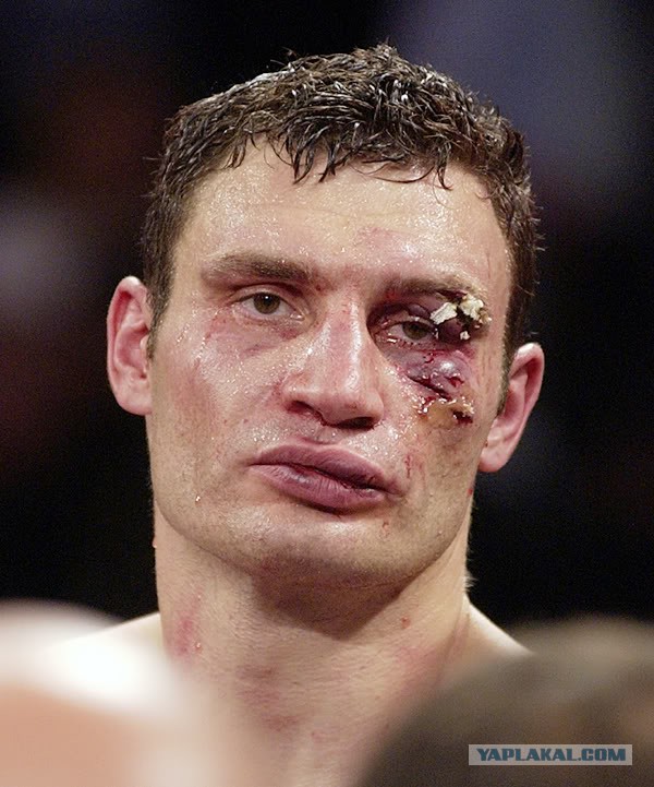 Кличко: опять Россия виновата!