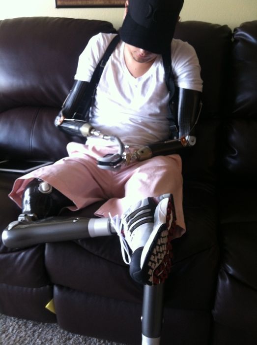 Удивительная сила воли и любовь к жизни!