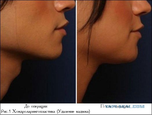 Не впечатлил