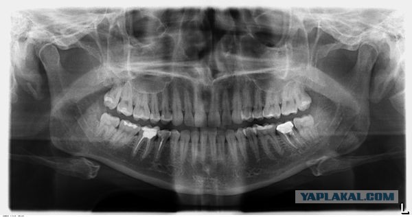Стоматолог рассказывает о людях, которые выбрали дорогой телефон вместо лечения. Зубы VS iPhone 7