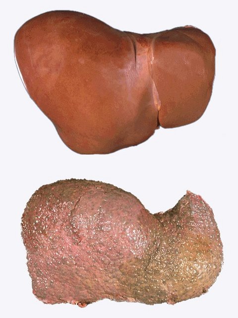 Новое творение  от обладателя Оскара  Тома Хупера!