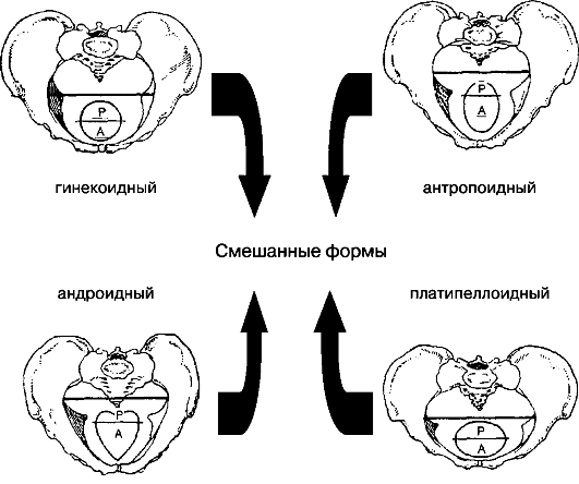 Брачное объявление (бабы налетай)