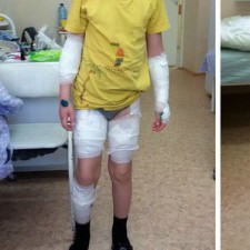 Стафорд загрыз детей и пенсионерку