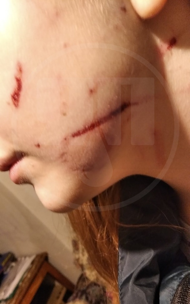 В Ростове-на-Дону взрослая женщина средь бела дня избила 13-летнюю школьницу. Оказывается жертва повздорила с дочерью обидчицы