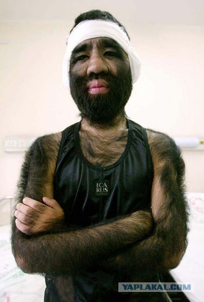 Безопасная Чечения