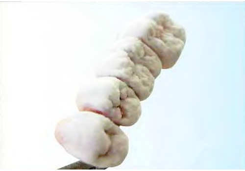 Зубы