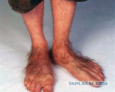 Как я ослеп