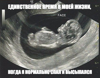 Картинки и гифки с юмором в честь дня малинового варенья