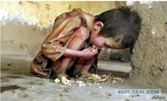 Гастрошунтирование или как я стал стройным