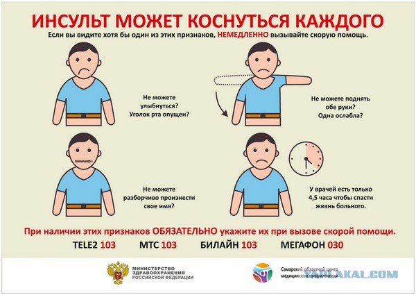 Инсульт. Остальным - приготовиться!