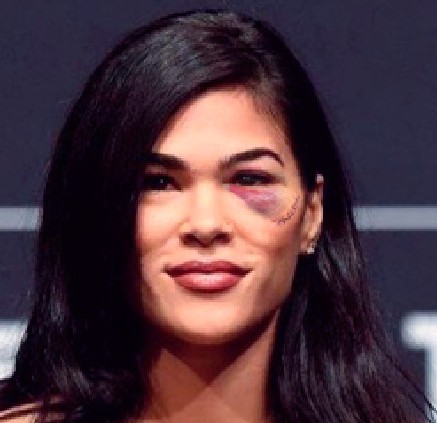 Самую горячую "бойцовую рыбку" из UFC избили, превратив её лицо в месиво