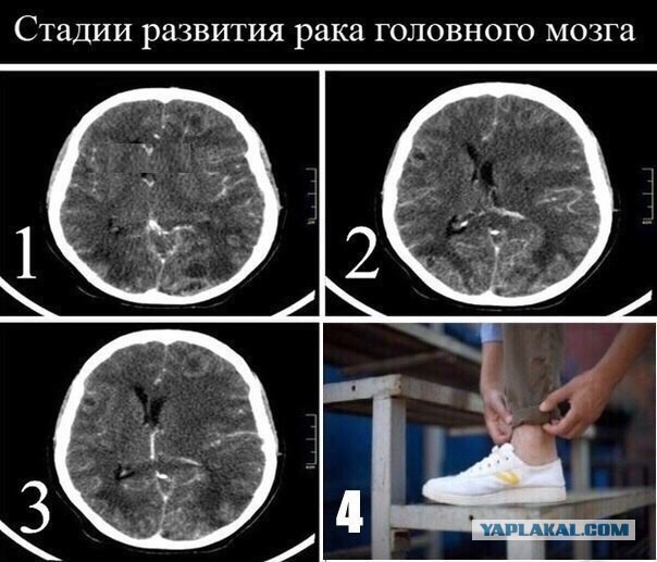 Зачем они так ходят?