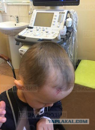ОнЖеОтец и ОнаЖеМать подняли все службы из-за царапины ребенка в детском саду. Приехала полиция, скорая и даже прокуратура!
