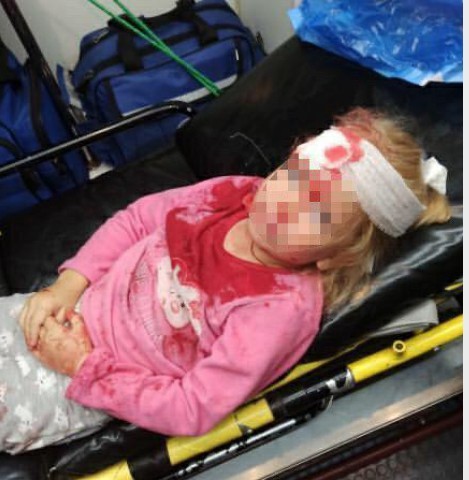 В Гродно во время акций протеста пострадала пятилетняя девочка