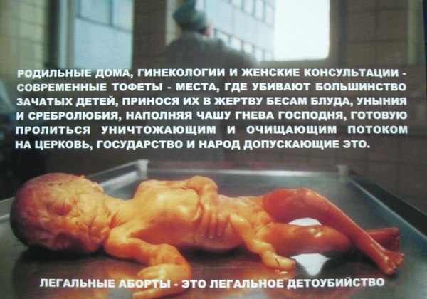 В России предложили проводить аборты после согласия отца ребенка