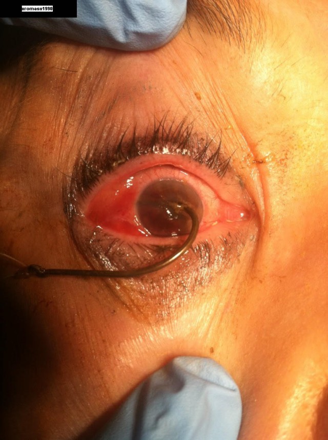 Неприятности разные, подборка. ч.2