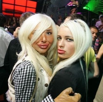 Когда друга укусила оса