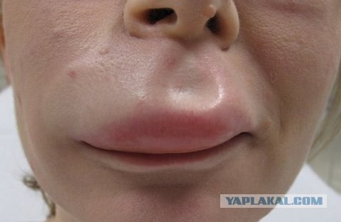 Покушение в стиле Билайн