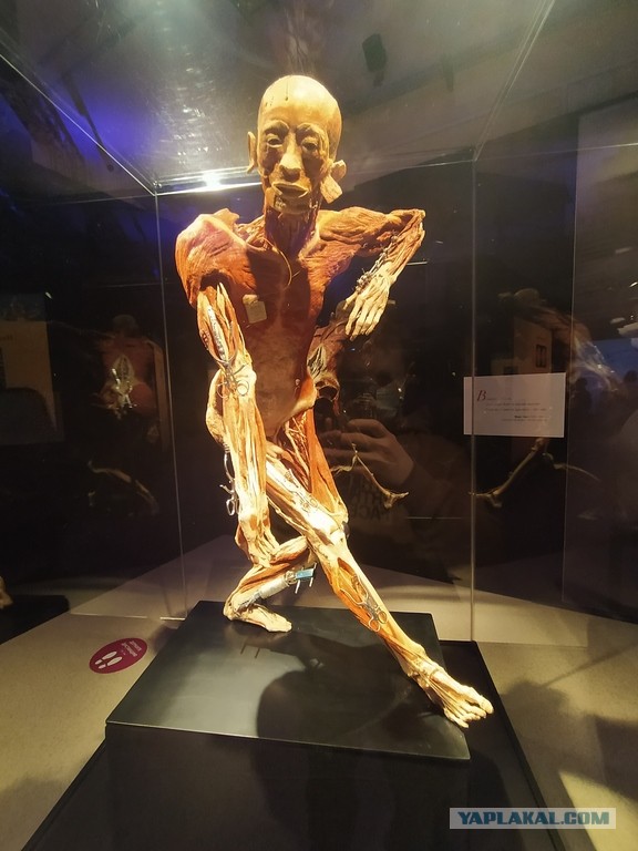 Посетил выставку Body Worlds на ВДНХ