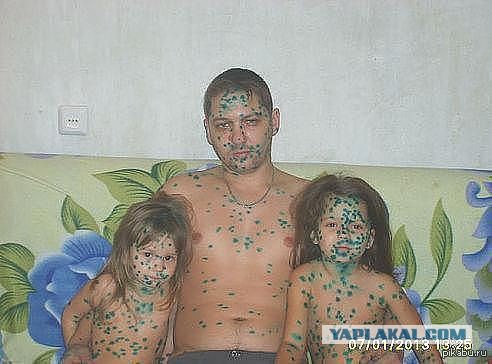 Всем зеленки!