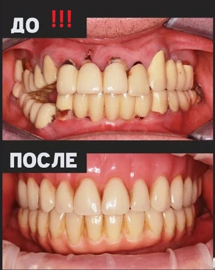 Что вытворяет стоматолог со мной после того, как просит расслабиться в кресле