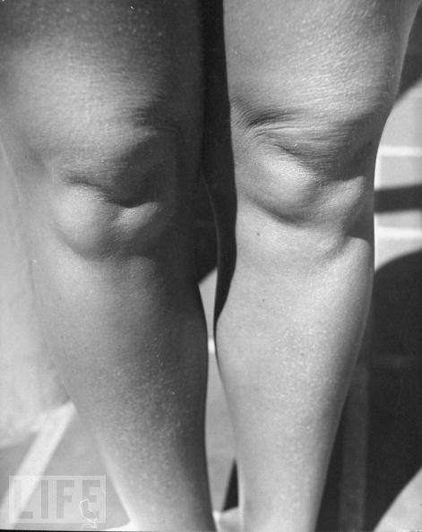 29 необычных фобий в фотографиях (29 фото)