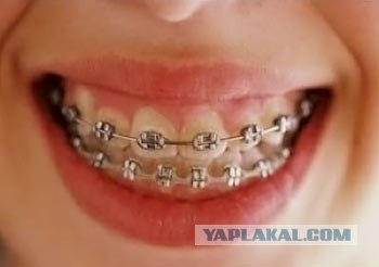Минет с прикусом