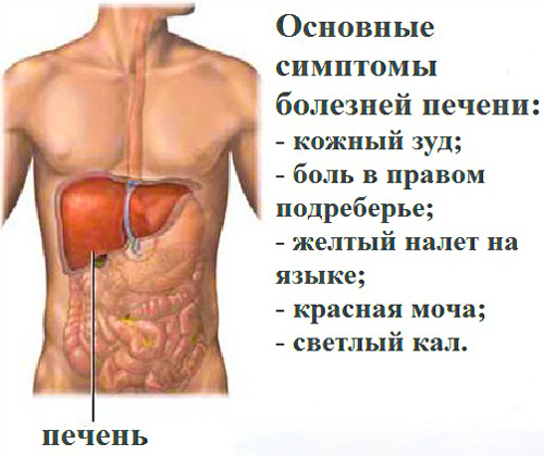 Как выглядит увеличенная печень у человека снаружи