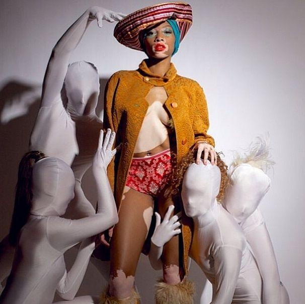 Шантель Винни