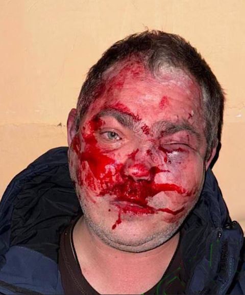 В Крыму избили посетителей кафе