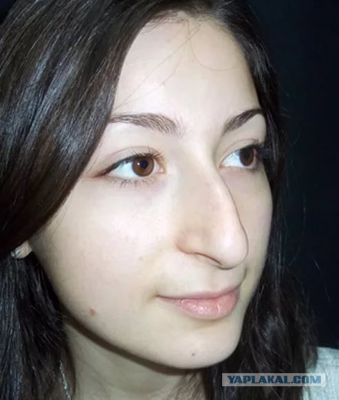 Те случаи, когда пластическая хирургия во благо