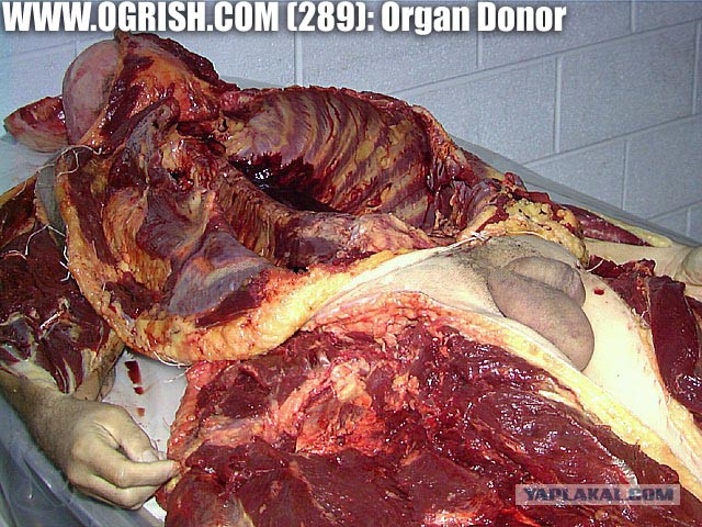 Ополченец говорит как "Укропы" поступают со своими