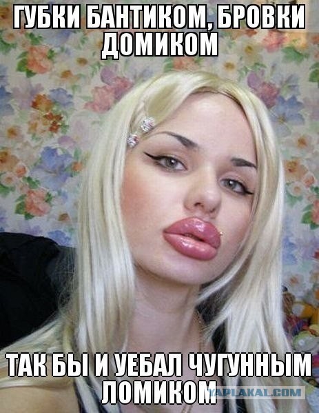 Из-за пухлых губ Вика вынуждена ходить