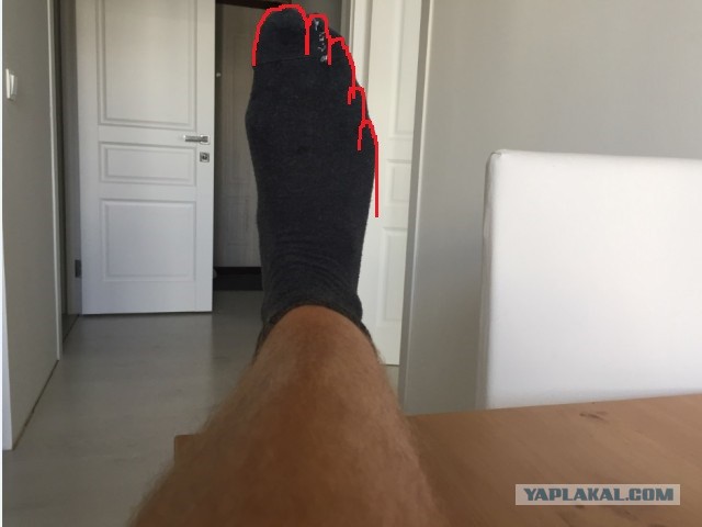 Как носки зашивать