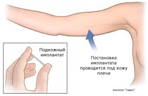 ДНК-экспертиза освободила от уплаты алиментов на 5 детей жителя Барановичского района