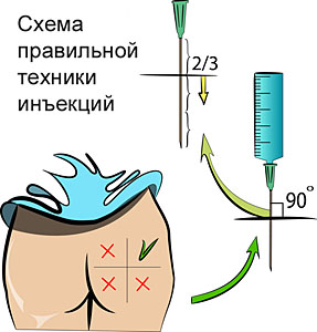 Кольщик,